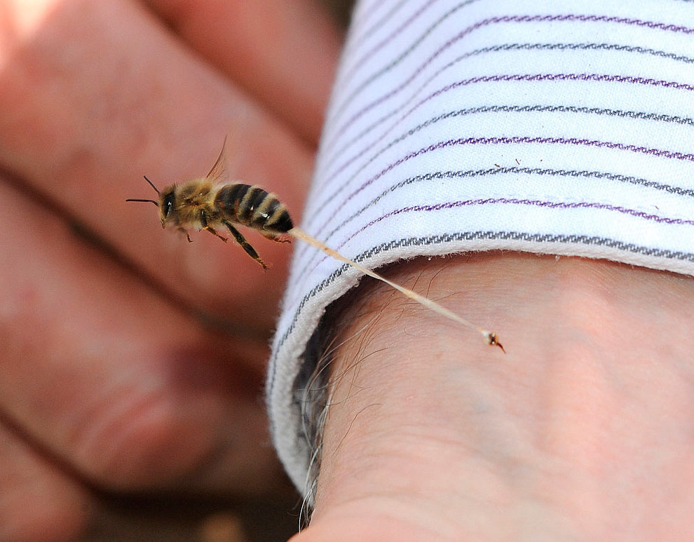 Укусила пчела что делать в домашних условиях